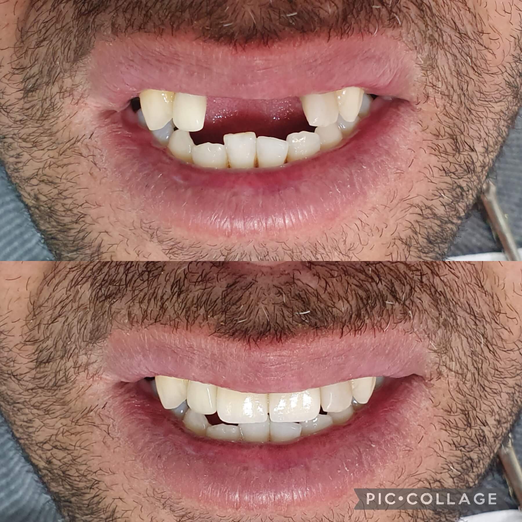 Collage_2023-07-04_16_58_03 (1)