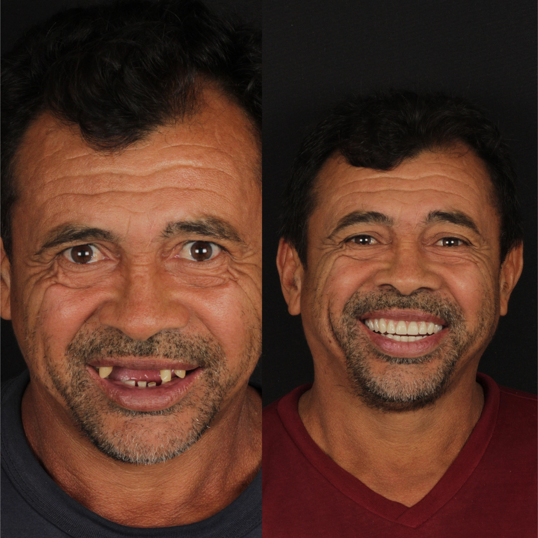Impro antes e depois