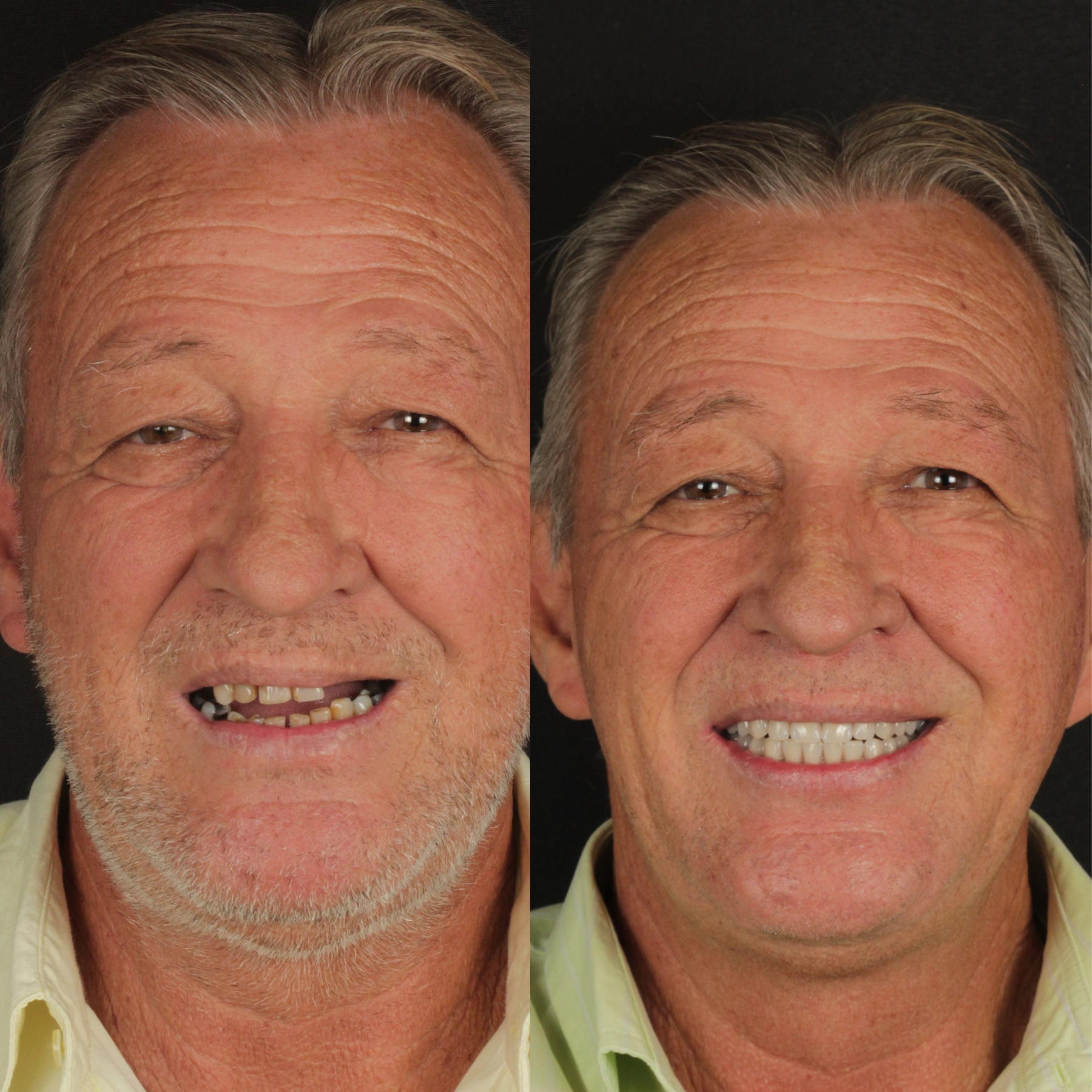 Impro antes e depois (3)